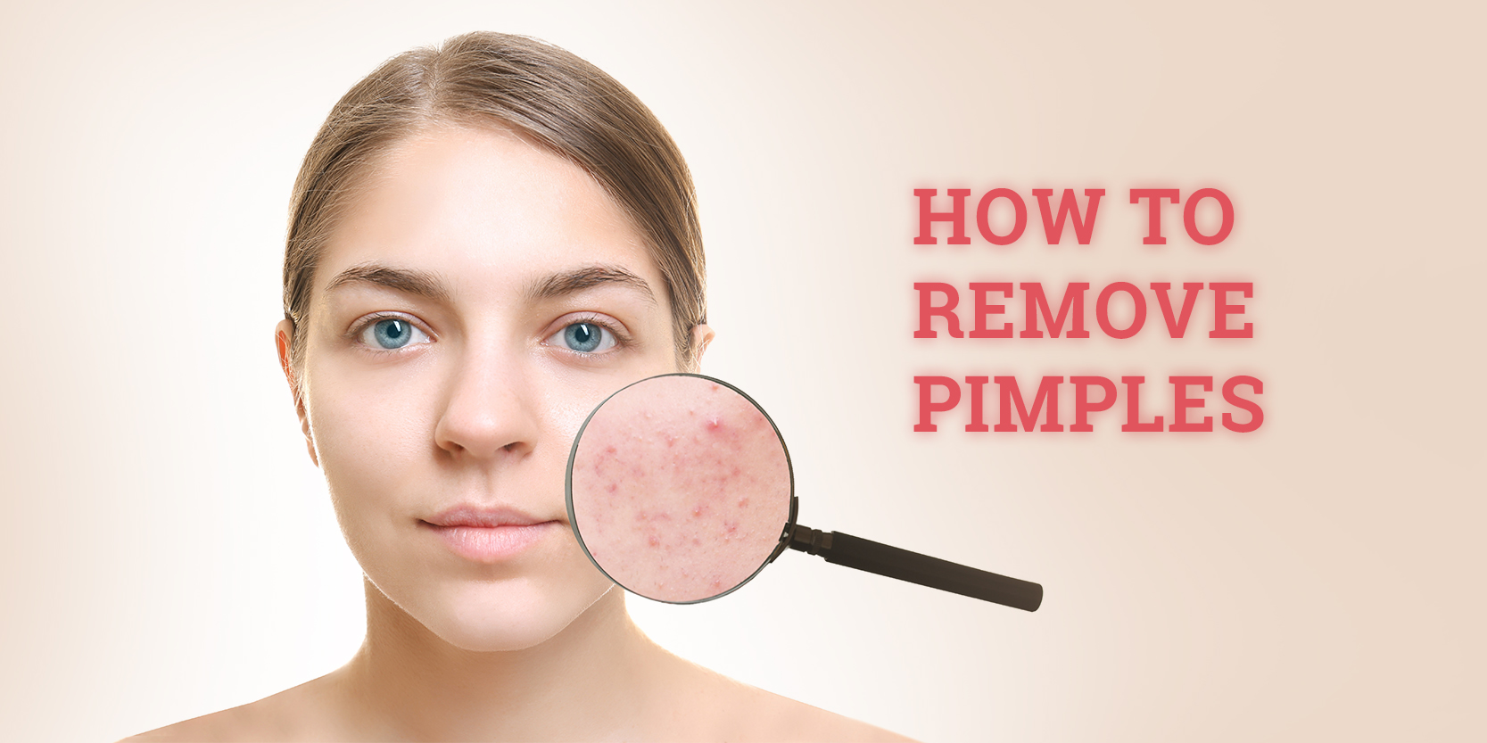 Top 10 Tips To Remove Pimples
